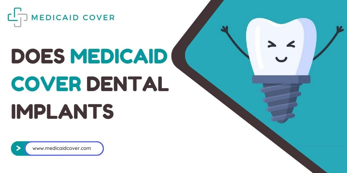 Does Medicaid cover dental implants