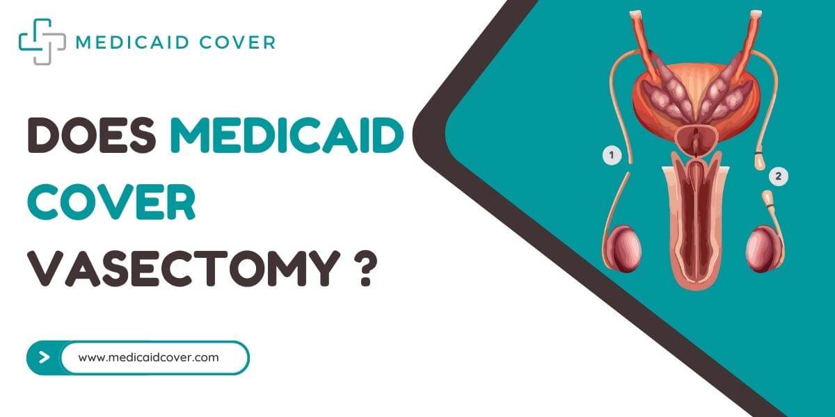 Does medicaid cover vasectomy