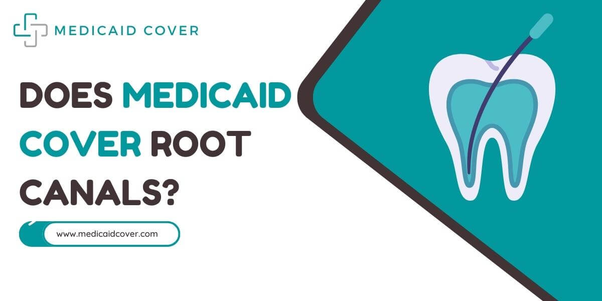 Does medicaid cover root canals